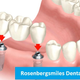 Illustration for article titled Selecting A Reputed Cosmetic Dentist | Rosenbergsmilesem/em